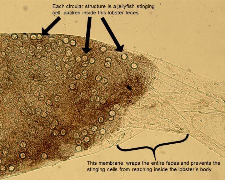 Empty circles are the nematocysts, or stinging cells, of jellyfish that have been packed together and wrapped tightly into packages of feces in the beginning of the lobster's digestive tract. The membrane, which can be seen extending off to the right side of the image, is a mechanical adaptation to prevent lobsters from being killed by their venomous food. Credit: Kaori Wakabayashi, Hiroshima University