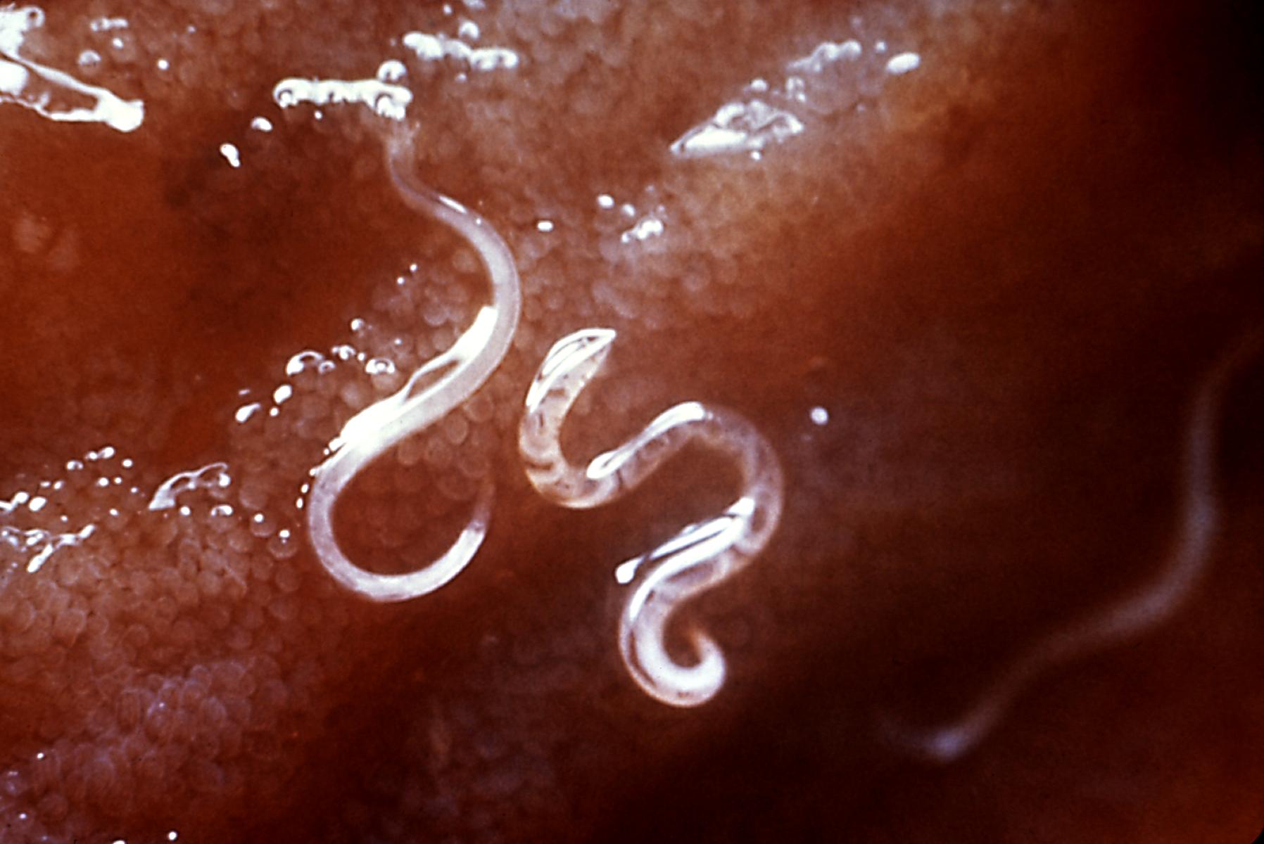 Hookworms. Credit: Wikimedia Commons